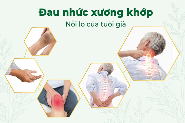 dau nhuc xuong khop